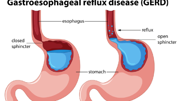 Aasif Khan s Chest Pain Scare Explained