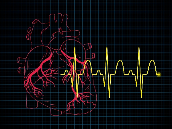 Cardiophobia When Fear Of Heart Attack