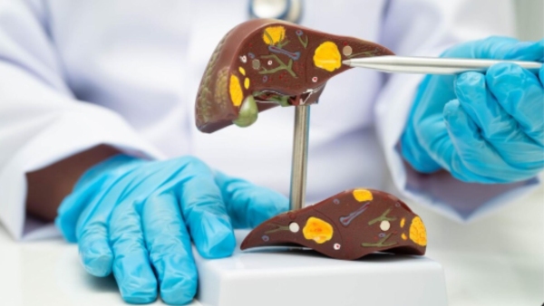 Tech Toxins And Takeout Dietitian Reveals How Modern Lifestyle Is Slowly Killing Your Liver Tech Toxins And Takeout Dietitian Reveals How Modern Lifestyle Is Slowly Killing Your Liver