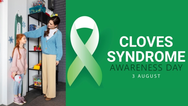 Cloves Syndrome Awareness Day 2025 Is Your Child s Overgrowth More Than Just Genetics Know The Signs Cloves Syndrome Awareness Day 2025 Is Your Child s Overgrowth More Than Just Genetics Know The Signs