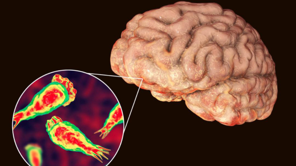9-Year-Old Dies From Brain-Eating Amoeba