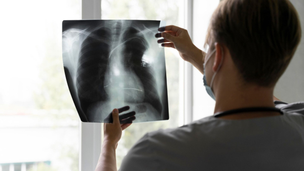 World Lung Cancer Day 2025 Lung Cancer Vs Asthma Double Check Symptoms Before It s Too Late