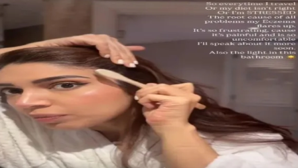 Bhumi Normalises Skin Imperfections