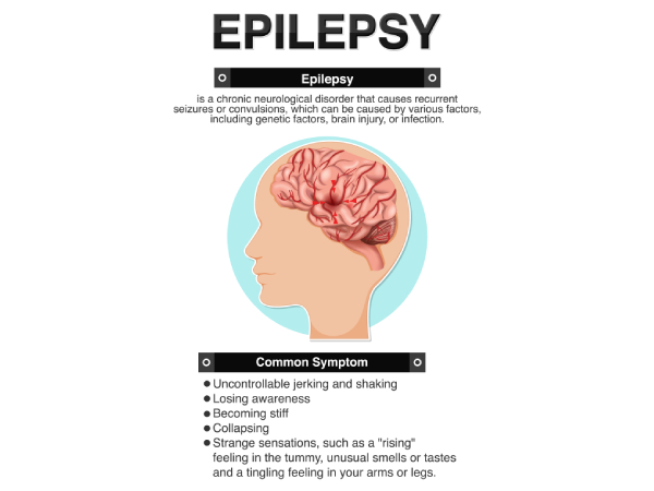 Epilepsy Stigma No One Talks About