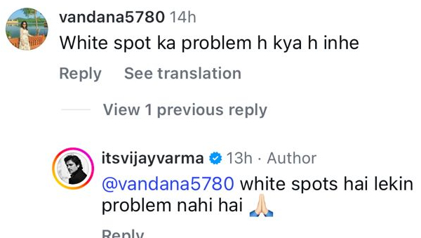 Vijay-Verma-vitiligo-comment