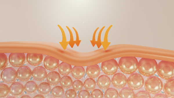 skin-microbiome skin-microbiome