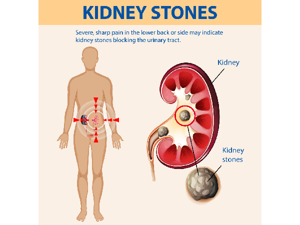 Summer Dehydration Warning Signs