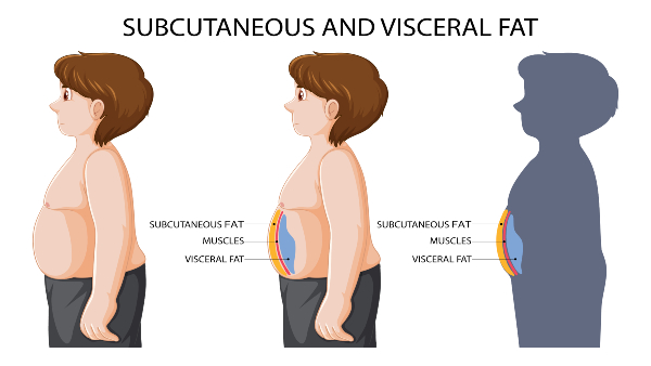 visceral-and-Subcutaneous-fat