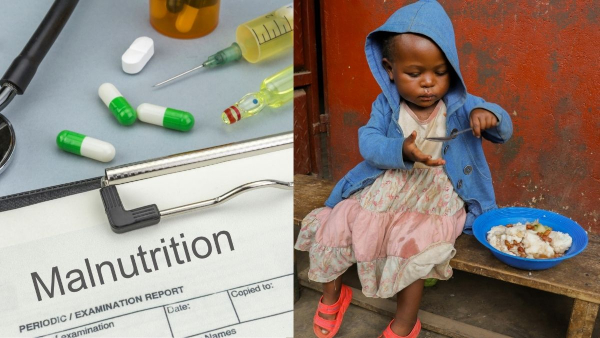 Malnutrition-and-gut-health