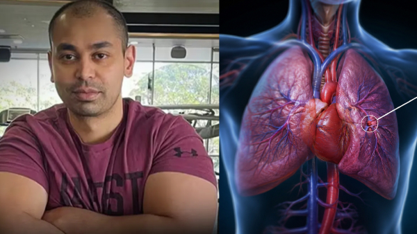 Prateek Yadav Postmortem Report Update