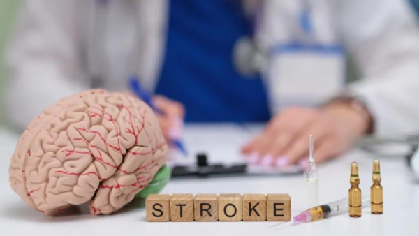 Stroke Center Care Explained Stroke Center Care Explained