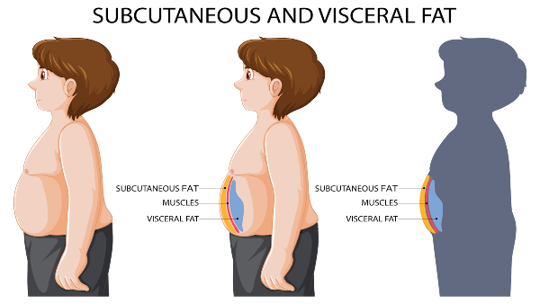 visceral-fat