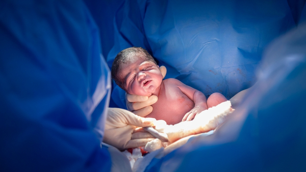 Birth malformations Birth malformations