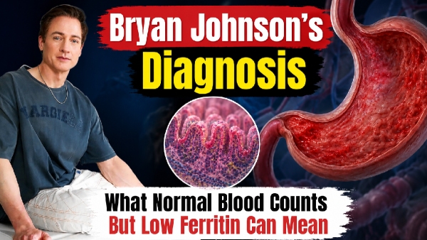 Bryan Johnson Autoimmune Gastritis Bryan Johnson Autoimmune Gastritis