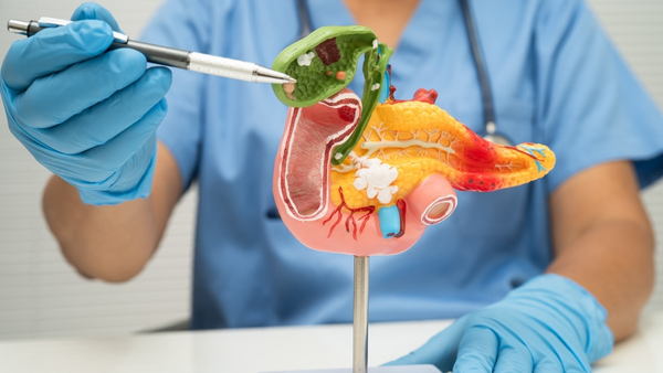 gallstones gallstones