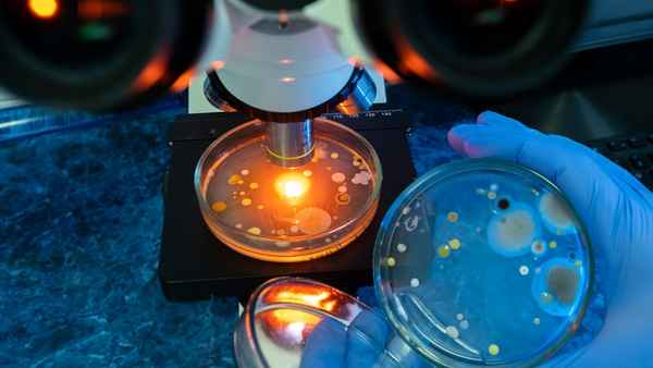 semen-analysis semen-analysis