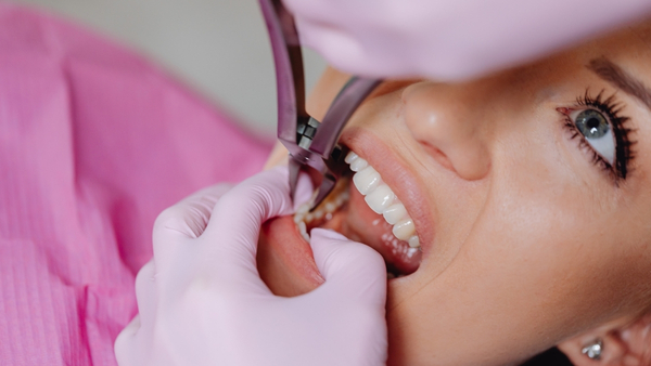 wisdom teeth extraction wisdom teeth extraction