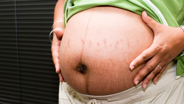 stretch-marks-during-pregnancy stretch-marks-during-pregnancy