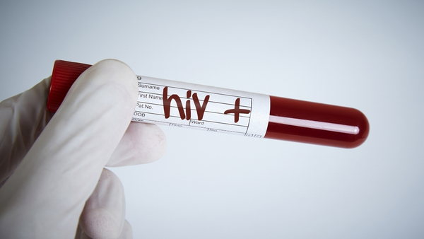 HIV-testing HIV-testing