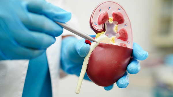 kidney-transplant-rejection kidney-transplant-rejection