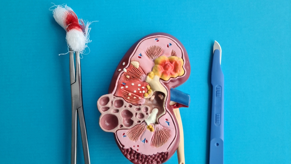 kidney-transplant-rejection-types kidney-transplant-rejection-types
