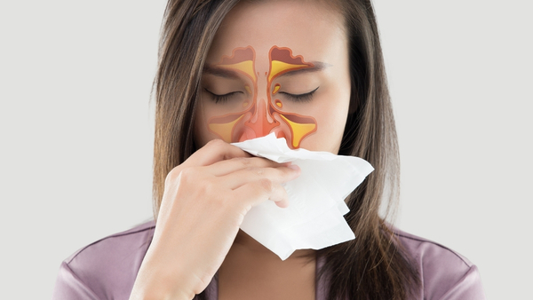 sinus-CT-scan sinus-CT-scan