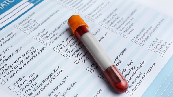 blood test blood test