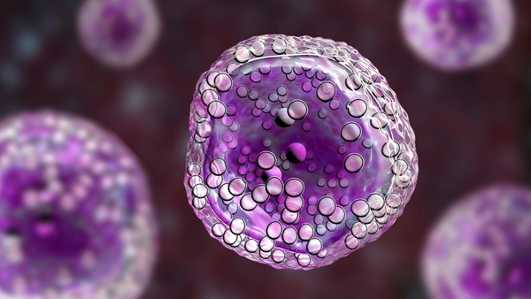 lymphoma lymphoma