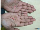 ಅಂಗೈಯಲ್ಲಿ ಈ X ಚಿಹ್ನೆ ಇದ್ದರೆ, ಅವರೇ ಅದೃಷ್ಟವಂತರು! 