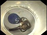 ಕುಡಿದ ಮತ್ತಿನಲ್ಲಿ ಮನೆಯ ಬೀಗದ ಕೈ ನುಂಗಿಬಿಟ್ಟ! 