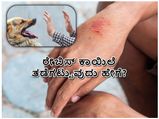 ವಿಶ್ವ ರೇಬಿಸ್‌ ದಿನ: ರೇಬಿಸ್‌ ಬಂದರೆ ಗುಣವಾಗುವುದೇ?  ರೇಬಿಸ್‌ ಕಾಯಿಲೆ ತಡೆಗಟ್ಟುವುದು ಹೇಗೆ?