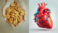 ಹೃದ್ರೋಗಿಗಳಿಗೆ ಈ 6 ಬಗೆಯ ಆಹಾರಕ್ರಮ ತುಂಬಾ ಒಳ್ಳೆಯದು