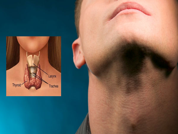 Natural Remedies For Thyroid Problem Natural Remedies For Thyroid Problem