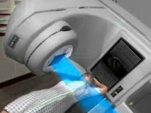 Radiotherapy Side Affect And Cure Radiotherapy Side Affect And Cure