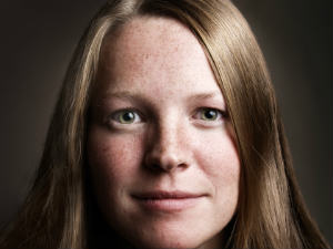 Home Remedies For Pigmentation Home Remedies For Pigmentation