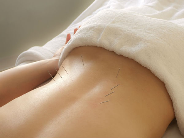 ಸೂಜಿ ಚಿಕಿತ್ಸೆ ಸೂಜಿ ಚಿಕಿತ್ಸೆ