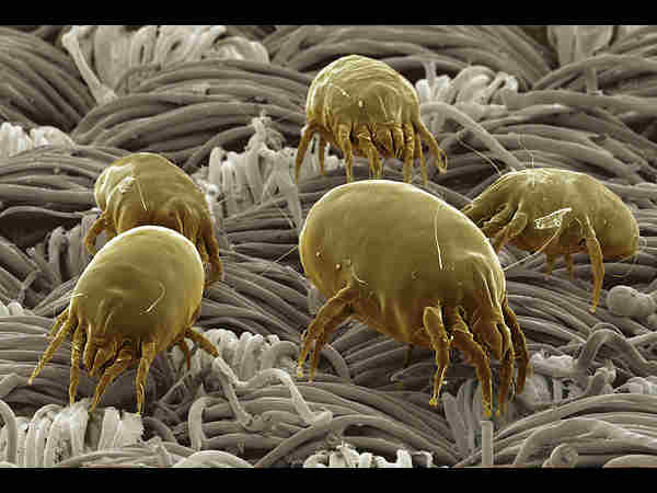 ಕಸದ ಧೂಳಿನ ಕಣಗಳು 