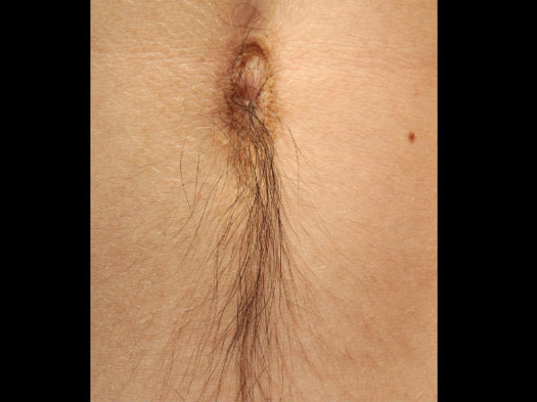 5. ಅಸ್ವಾಭಾವಿಕ ಕೂದಲಿನ ಬೆಳವಣಿಗೆ