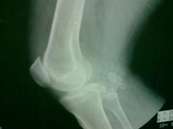 ವಿದ್ಯುತ್ಕಾಂತೀಯ ಅಲೆಗಳು