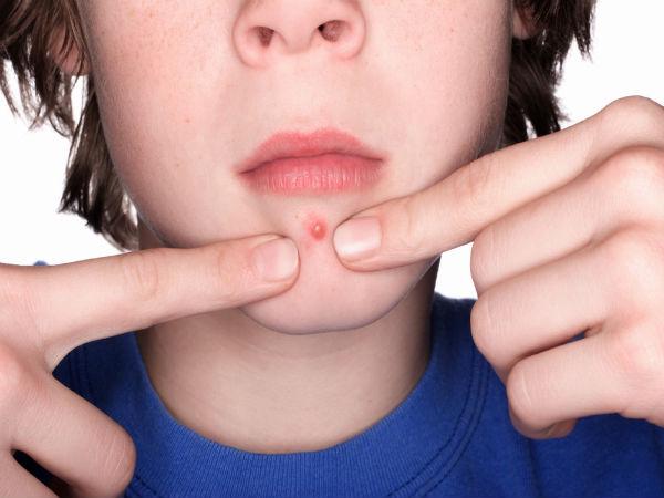 ದೇಹದಲ್ಲಿ ಗುಳ್ಳೆಗಳು ಕಂಡುಬಂದರೆ ದೇಹದಲ್ಲಿ ಗುಳ್ಳೆಗಳು ಕಂಡುಬಂದರೆ