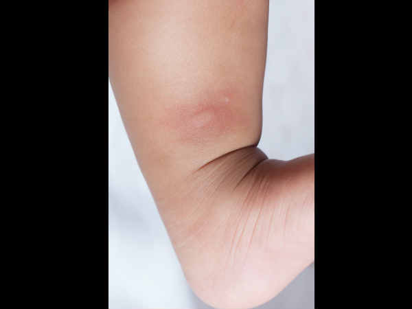 ಕತ್ತಲೆಯಾದ ಬಳಿಕ ಹೆಚ್ಚು ಓಡಾಡದಿರಿ