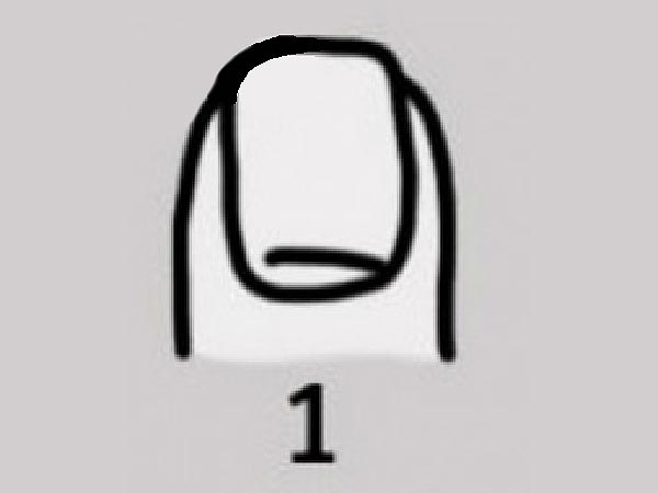 ಅಗಲವಾದ, ಚಪ್ಪಟೆಯಾದ ಉಗುರುಗಳು