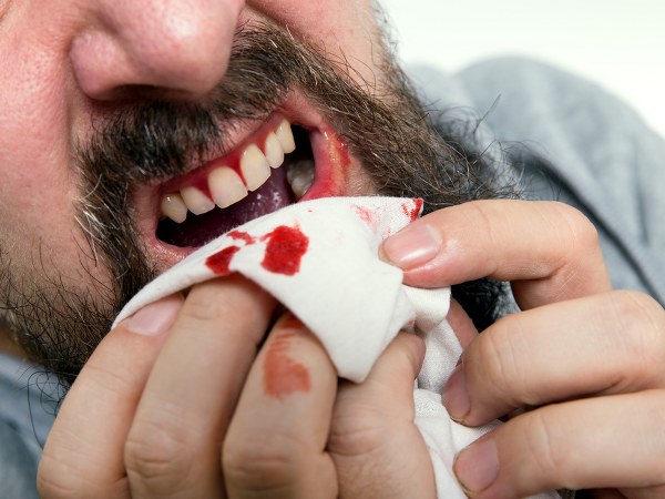 ತ್ರೊಂಬೊಸಿಟೊಪೆನಿಯಾ