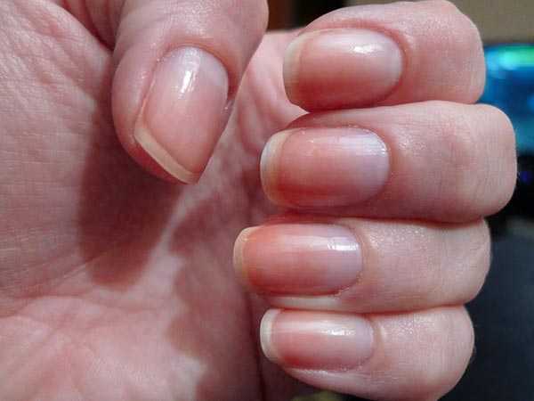 Simple Home Treatments to Keep Nails Healthy 