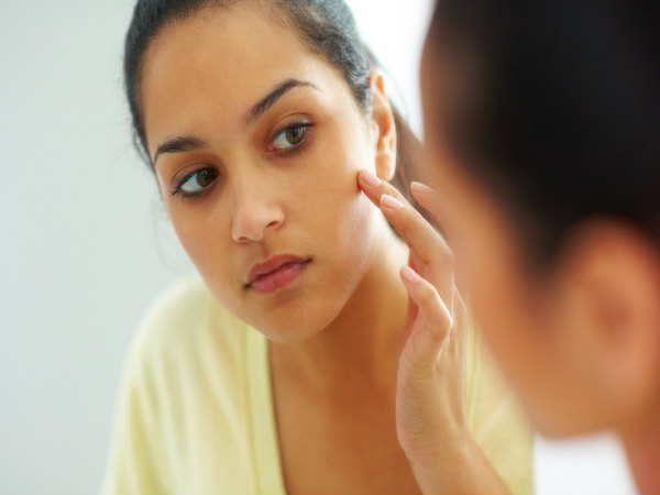 Here’s why you frequently get acne on the chin and T-zone Here’s why you frequently get acne on the chin and T-zone