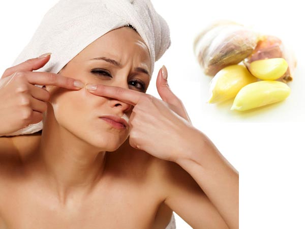 Garlic Mask Recipes Garlic Mask Recipes