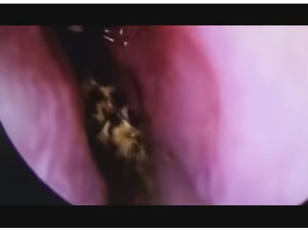 ವಿಡಿಯೋ ನೋಡಿ.... ವಿಡಿಯೋ ನೋಡಿ....