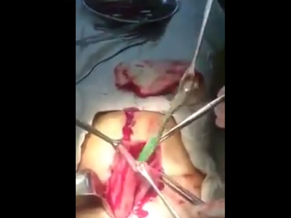 ವೀಡಿಯೋ ನೋಡುವ ಧೈರ್ಯವಿದೆಯೇ?