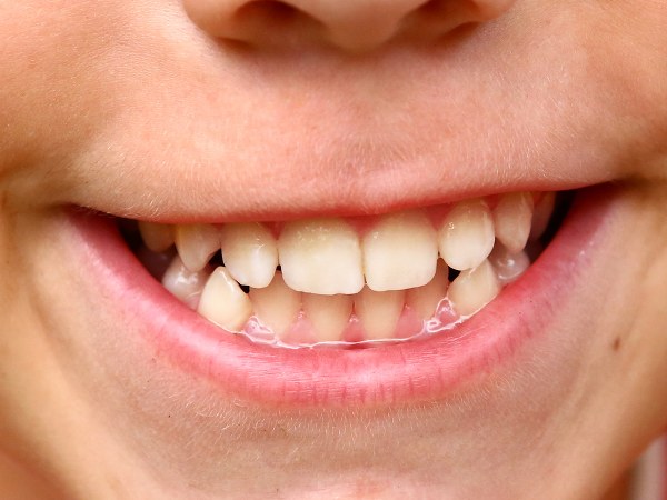 ಇವರ ಆಹಾರಕ್ರಮ ಆರೋಗ್ಯಕರವಾಗಿರುತ್ತದೆ