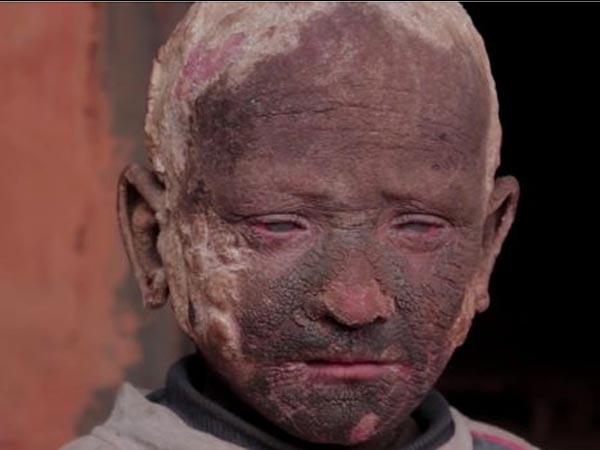 ಕೊನೆಗೆ ಬಿಟ್ರನ್‌ನ ಗಾಯಕಿ ಜಾಸ್ ಸ್ಟೋನ್ ನೆರವಾದಳು